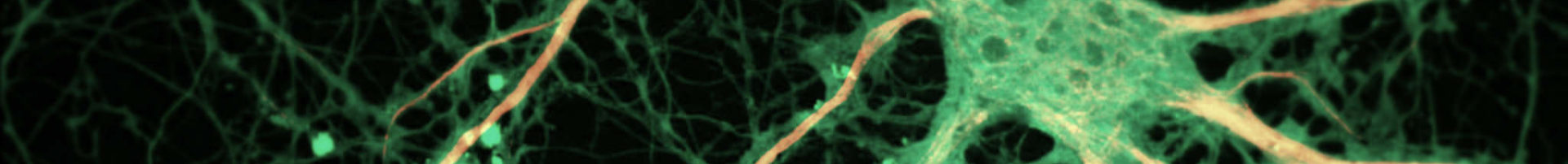 HVS Image